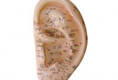 AURICULOTERAPIA